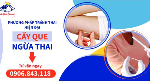 QUE CẤY TRÁNH THAI – Những điều cần biết