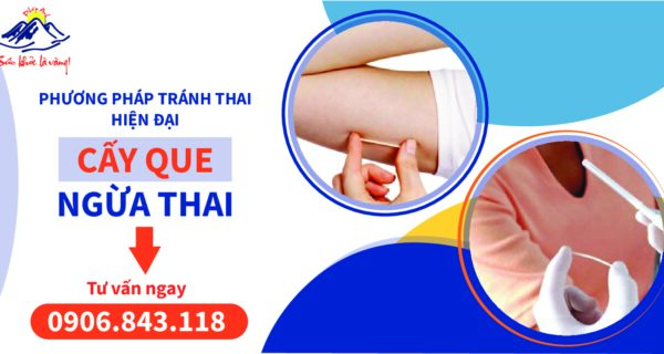 QUE CẤY TRÁNH THAI – Những điều cần biết