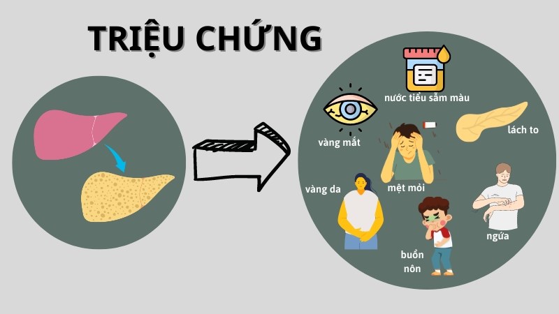 Các triệu chứng phổ biến của gan nhiễm mỡ