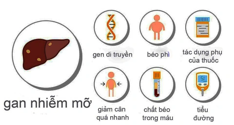 Một số nguyên nhân gan nhiễm mỡ