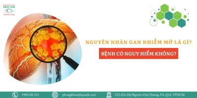 Nguyên nhân gan nhiễm mỡ là gì?